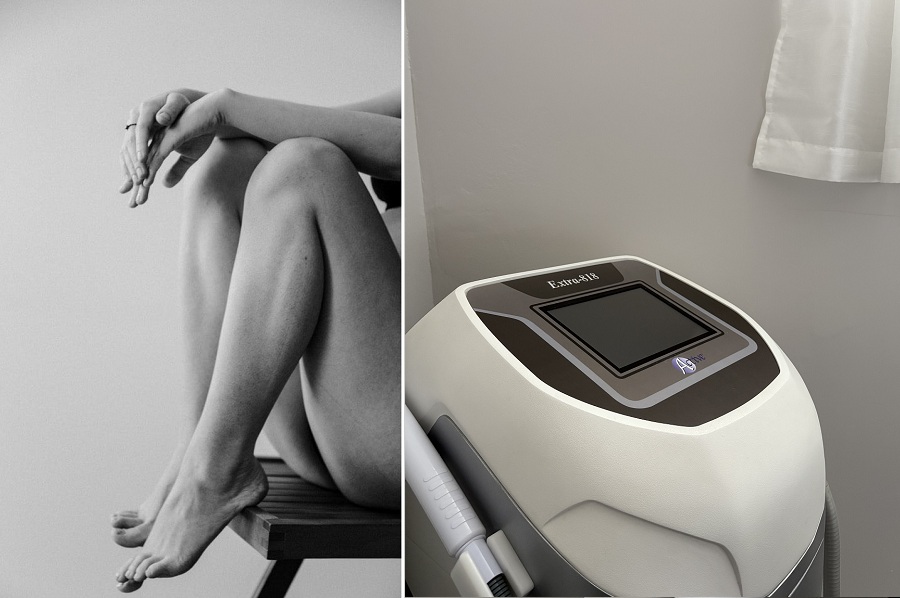 Épilation à la lumière pulsée (IPL)