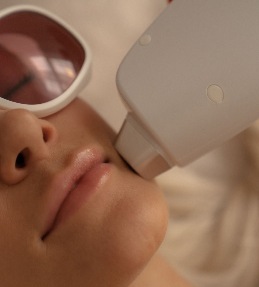 Photorajeunissement IPL